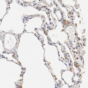 Anti-TAGLN2 antibody produced in rabbit HPA001925-100UL