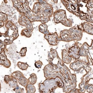 Anti-TAGLN2 antibody produced in rabbit HPA001925-100UL