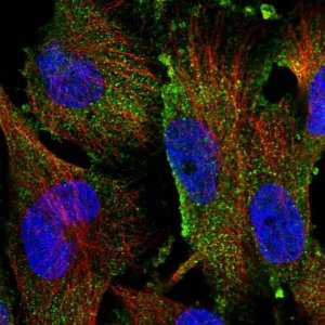 Anti-TAMM41 antibody produced in rabbit 