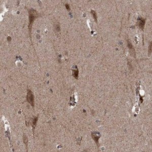 Anti-TANC2 antibody produced in rabbit 