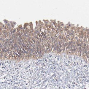 Anti-TANGO2 antibody produced in rabbit 