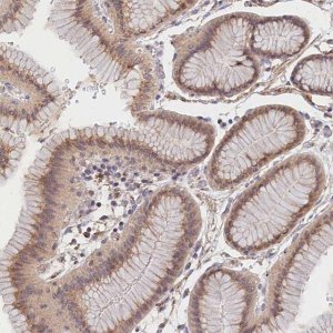 Anti-TANGO6 antibody produced in rabbit 