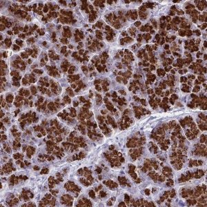 Anti-TANK antibody produced in rabbit 