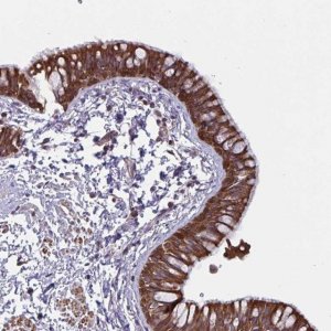 Anti-TANK antibody produced in rabbit 