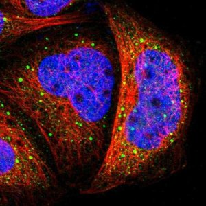 Anti-TAOK1 antibody produced in rabbit 