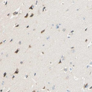 Anti-TAOK2 antibody produced in rabbit 