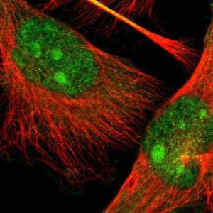 Anti-TAOK2 antibody produced in rabbit 