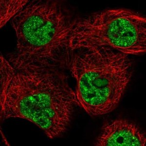 Anti-TARBP1 antibody produced in rabbit 