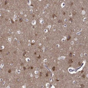 Anti-TARBP2 antibody produced in rabbit 