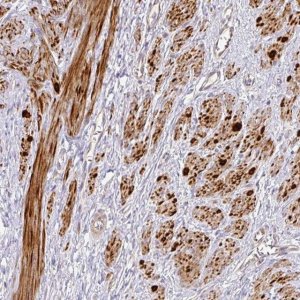 Anti-TARM1 antibody produced in rabbit 