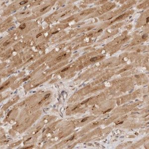 Anti-TARS2 antibody produced in rabbit 