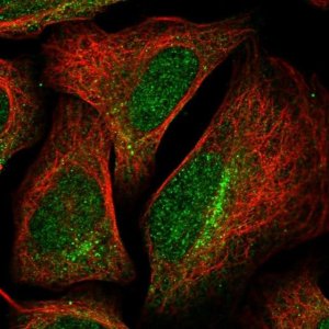 Anti-TARS2 antibody produced in rabbit 