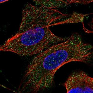 Anti-TARSL2 antibody produced in rabbit 