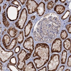 Anti-TAS1R1 antibody produced in rabbit 