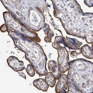 Anti-TASP1 antibody produced in rabbit 