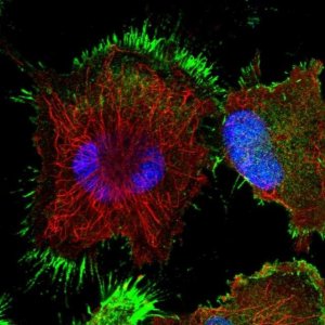 Anti-TASP1 antibody produced in rabbit 
