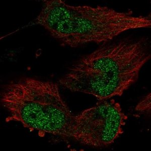 Anti-TATDN1 antibody produced in rabbit 