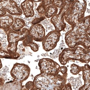 Anti-TAX1BP1 antibody produced in rabbit 