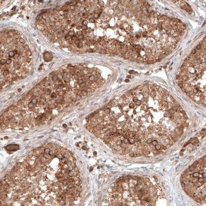 Anti-TAX1BP1 antibody produced in rabbit 