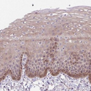 Anti-TAX1BP3 antibody produced in rabbit HPA063078-100UL