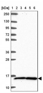 Anti-TAX1BP3 antibody produced in rabbit HPA063078-100UL