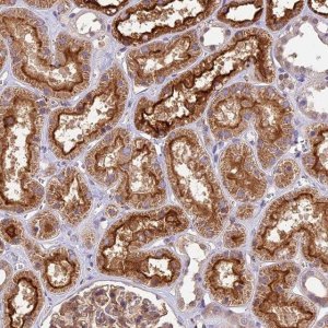 Anti-TBC1D1 antibody produced in rabbit 