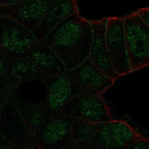Anti-TBC1D10A antibody produced in rabbit HPA007725-100UL