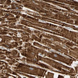 Anti-TBC1D10A antibody produced in rabbit HPA008142-100UL