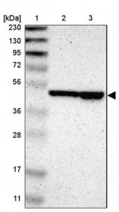 Anti-TBC1D10A antibody produced in rabbit HPA008142-100UL