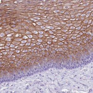 Anti-TBC1D10B antibody produced in rabbit 