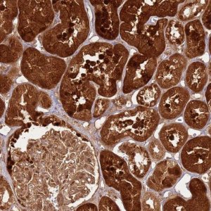 Anti-TBC1D13 antibody produced in rabbit 
