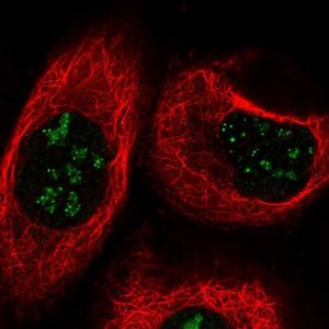 Anti-TBC1D13 antibody produced in rabbit 
