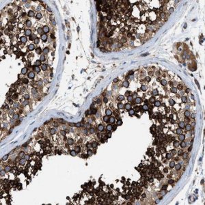 Anti-TBC1D15 antibody produced in rabbit 