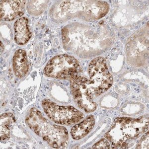Anti-TBC1D16 antibody produced in rabbit 