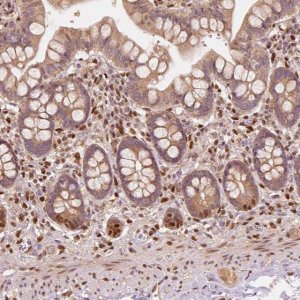 Anti-TBC1D17 antibody produced in rabbit 