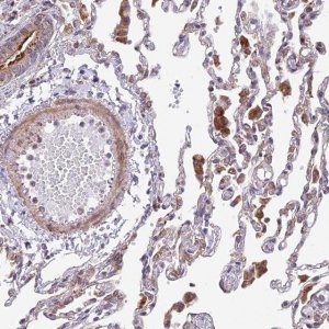 Anti-TBC1D20 antibody produced in rabbit 