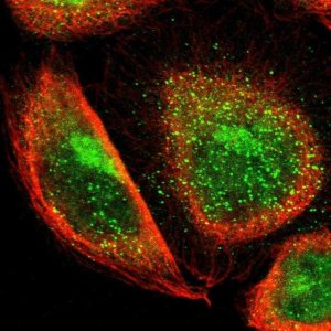 Anti-TBC1D22A antibody produced in rabbit 