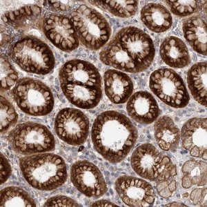 Anti-TBC1D22B antibody produced in rabbit 