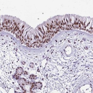 Anti-TBC1D26 antibody produced in rabbit 