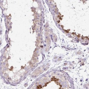 Anti-TBC1D3L antibody produced in rabbit 