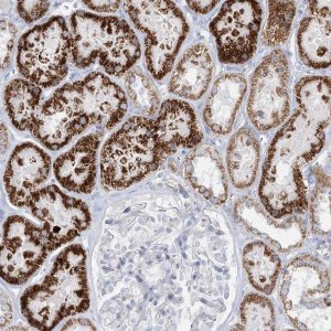 Anti-TBC1D7 antibody produced in rabbit 
