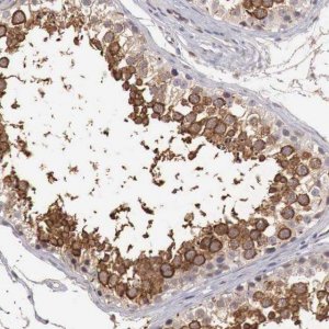 Anti-TBC1D9 antibody produced in rabbit 