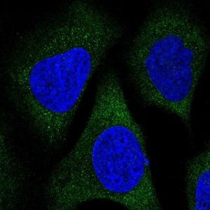 Anti-TBCEL antibody produced in rabbit 