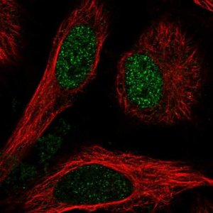 Anti-TBL1X antibody produced in rabbit 