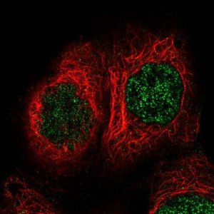 Anti-TBRG1 antibody produced in rabbit 