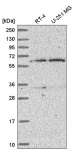 Anti-TBRG4 antibody produced in rabbit 