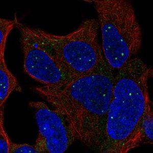 Anti-TBX1 antibody produced in rabbit 