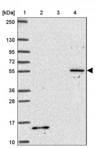 Anti-TBX15 antibody produced in rabbit 