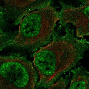 Anti-TBXA2R antibody produced in rabbit 