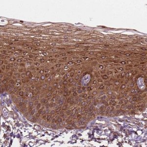 Anti-TCAF1 antibody produced in rabbit 